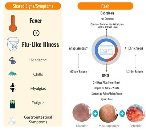 Tick Borne Illnesses Symptoms Rebel Em Emergency Medicine Blog