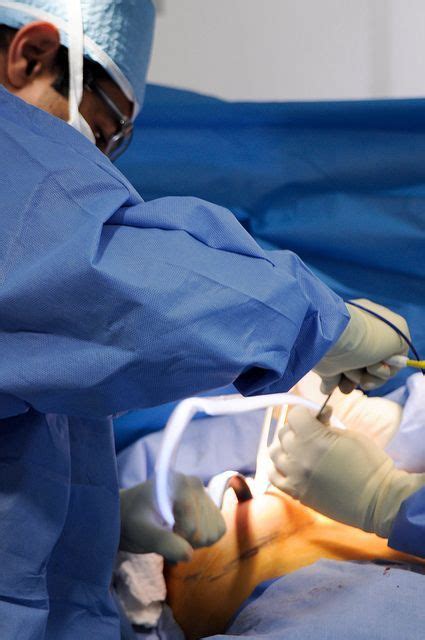 Pin on plastic-surgery-tips