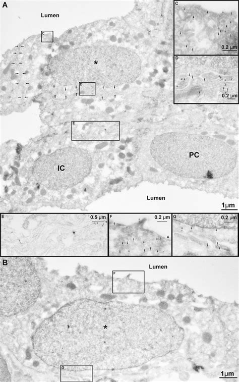 We did not find results for: Double-labeled cells have an ultrastructure similar to ...