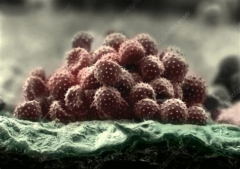 Fungal spores, SEM - Stock Image - B250/0994 - Science Photo Library