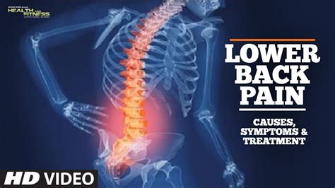 Lower Back Pain Its Causes Symptoms And Treatment Youtube