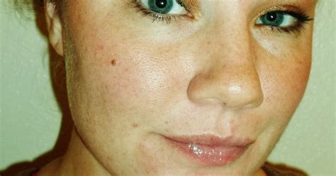7 Reasons To Love Your Freckles Immediately — Theyre A Form Of