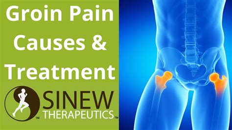 Groin Pain Causes And Treatment Youtube