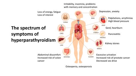 Signs And Symptoms Of Hyperparathyroidism Thyroid Sydney My XXX Hot Girl