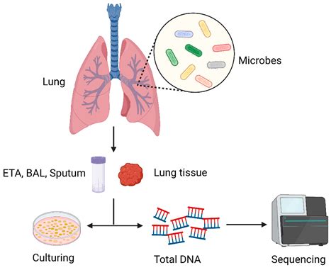 Ijms Free Full Text The Lung Microbiome A New Frontier For Lung