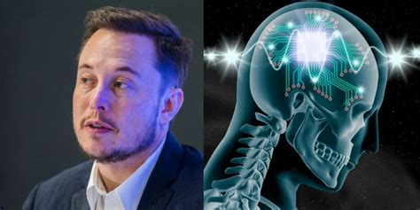 Elon Musks Neuralink To Start Human Trials This Year As Long As