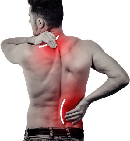 Muscle Pain Myofascial Pain Syndrome