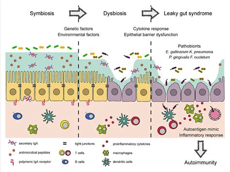 Figure 1 From Partners In Leaky Gut Syndrome Intestinal Dysbiosis And