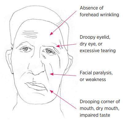 We did not find results for: KRV- Face Paralysis Treatment | Bells Palsy Treatment in Gurgaon