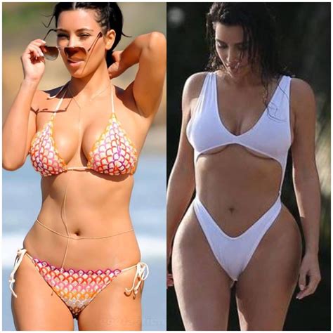 Kim Kardashian Hip And Butt Injections Before And After Kim Kardashian