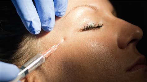 Best Botox Areas In Saint Marys City Maryland Mid Atlantic Skin