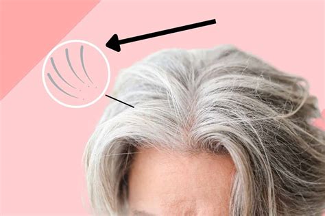 How To Stop Grey Hair From Sticking Out 7 Easy Ways