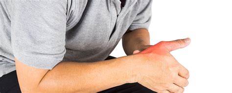 5 Signs Of A Thumb Sprain The Hand Society