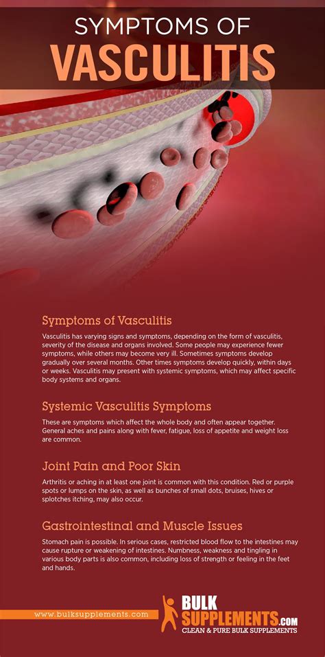 Vasculitis Symptoms Causes And Treatment By James Denlinger Medium