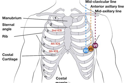 Pediatric Ekg 15 Lead Placement Diagram Diagram Back Muscles Otosection