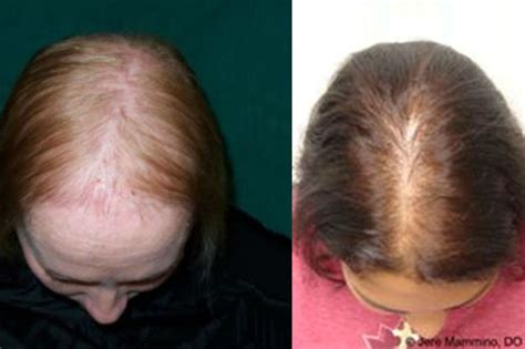 Please fill out this form and remember there are no wrong answers. - Hair Loss Network