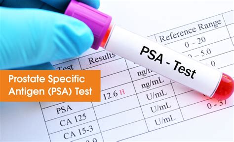 Ast Or Sgot Blood Test High And Low Levels And What Do Results Mean