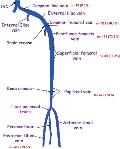Clinical Implications Of The Anatomical Variation Of Deep Venous