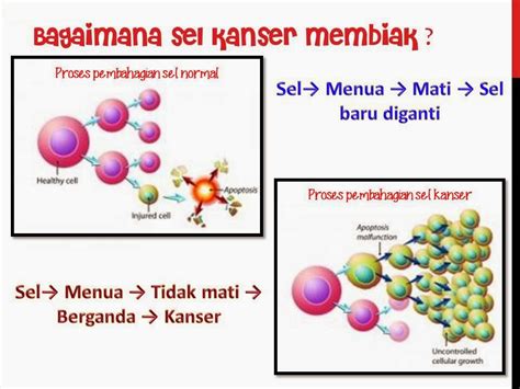 Penanganan limfoma sangat bergantung pada jenis dan stadium limfoma. Apa Itu Kanser - Punca Dan Rawatan | Healthy Living