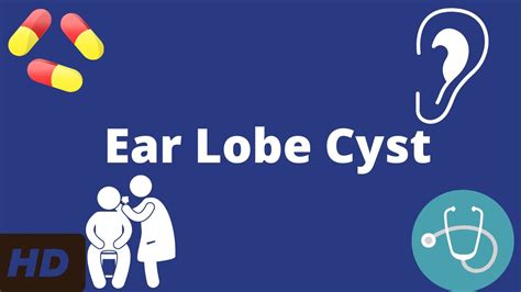Ear Lobe Cyst Everything You Need To Know Youtube