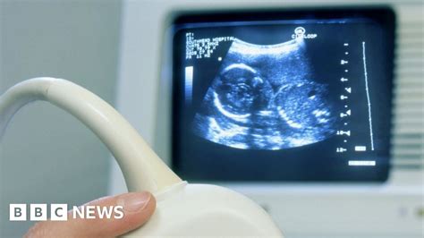 freezing ovaries safe option for cancer sufferers bbc news