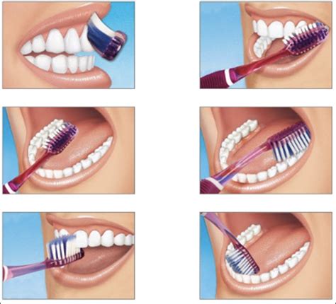 La Guia Esencial Para La Higiene Dental