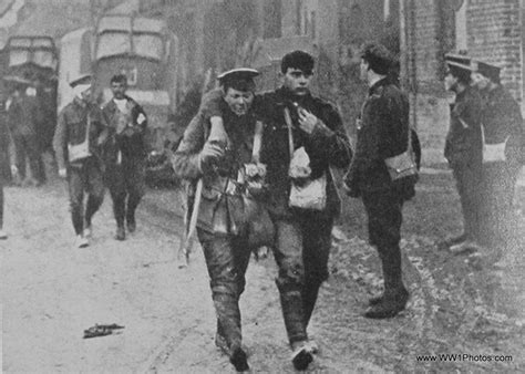 Photos Of Wounded First World War Soldiers