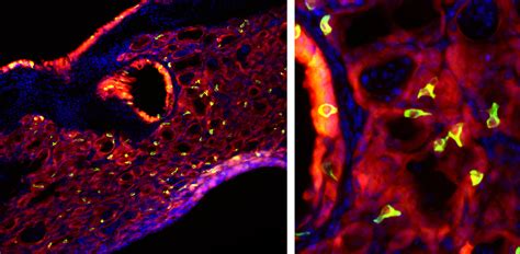 Smooth muscle cells and nerve cells. A bad bout of flu triggers 'taste bud cells' to grow in ...