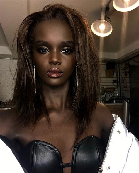Duckie Thot Reveals She Was Involved In A Car Accident Prior To The Victorias Secret Fashion