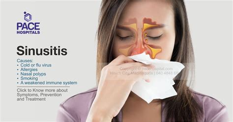 Sinusitis Pictures