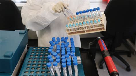 Sie sind nicht für diagnostische zwecke dass kein einziger pcr test existiert, der in der lage ist, infektionen festzustellen, habe sich ab welcher anzahl von verdoppelungszyklen der färbetest als positiv betrachtet werden kann. Zum ersten Mal über 9 Prozent positive PCR-Tests - Nachrichten