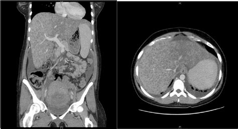 Ct Abdomen And Pelvis Download Scientific Diagram