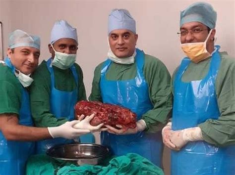 Doctors Remove 74kg Kidney Heavier Than A Bowling Ball From Patient