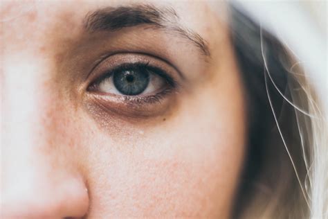 Bags Under Eyes Focus On 12 Things Acupuncture Points