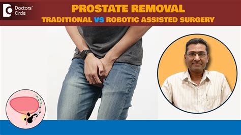 Robotic Vs Open Prostate Surgery Pros Cons Prostate Cancer Dr Girish Nelivigi Doctors