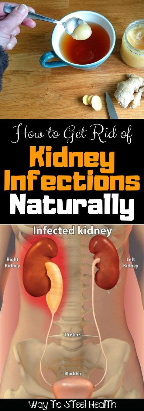 How To Get Rid Of Kidney Infections Naturally Kidney Infection