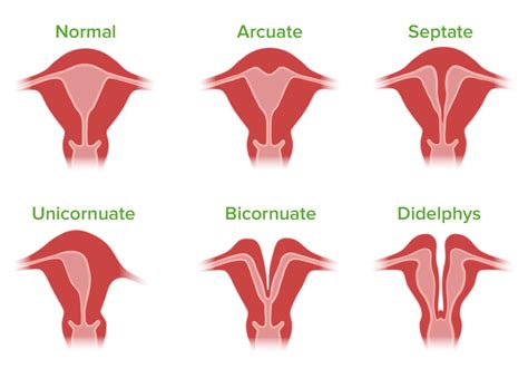 Female Reproductive System Diseases Uterus Womb Anatomy Thin Line