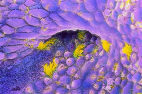 Sanaz memarzadeh, gynecological surgeon with ucla jonsson comprehensive cancer center, shares signs. Ovarian cancer vaccine improves women's survival rates ...