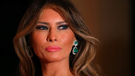 Melania Makeover Furor En Eeuu De Mujeres Que Se Operan Para Parecerse A La Primera Dama