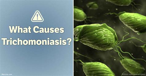 What Causes Trichomoniasis