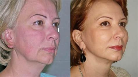 Check spelling or type a new query. Pin on plastic surgery