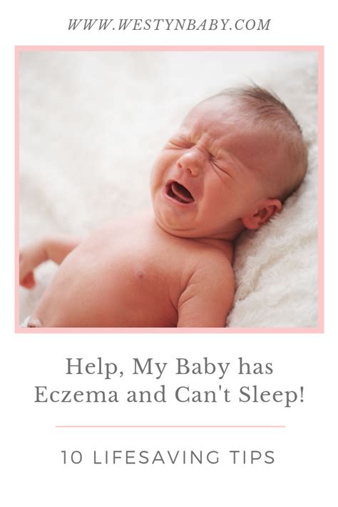 Baby With Eczema Not Sleeping 10 Tips For A More Peaceful Nights Rest