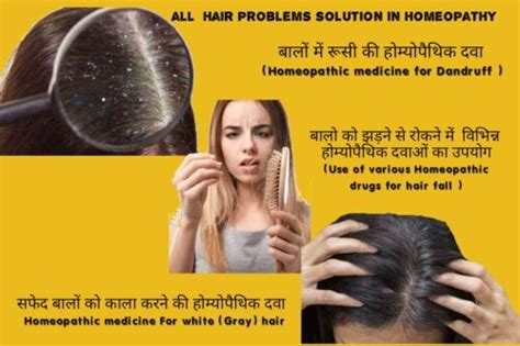 Details More Than Fluoric Acid Homeopathy Hair Loss Best In Eteachers