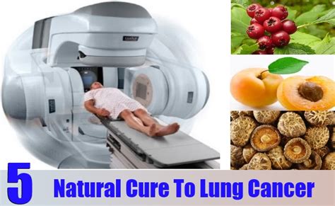 5 Natural Cure For Lung Cancer How To Cures Lung Cancer Naturally