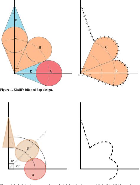 Figure From The Adaptability And Utility Of The Bilobed Transposition