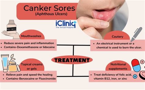 Canker Sore Stages
