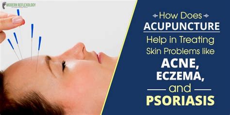 Acupuncture For Skin Disorders Treating Acne Eczema Psoriasis