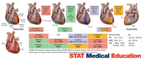 12 Lead And Stemi Placement Arteries Anatomy Nursing Tips Cardiac