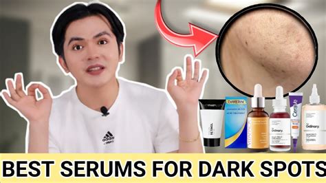 Best Serums For Dark Spots Totoong Effective Youtube