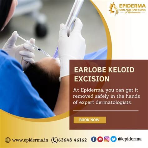 Ppt Earlobe Keloid Excision Best Dermatology Centre In Jayanagar